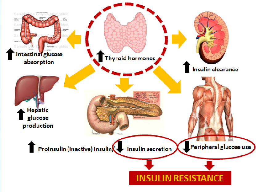 diabetic-ketoacidosis-in-a-patient-with-thyroid-storm-discussion