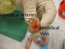 umbilical arteries vein