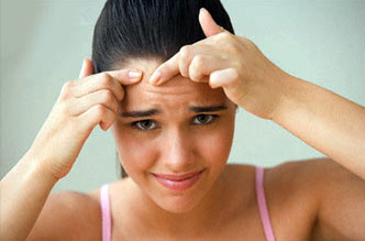 Acne And Pimples Are Embarrassing!