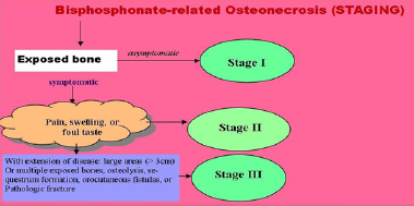figure-3-staging-of-bisphosphonate-related-osteonecrosis
