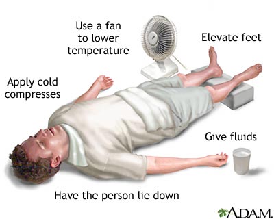 Heat Stroke: What to do?