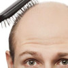 Here Is Why Your Hair Transplant Did Not Turn Out The Way You Expected image