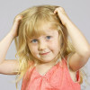How to Get Rid Of Head Lice At Home image