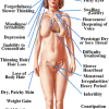 Underactive Thyroid image