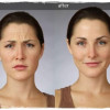 The Pros and Cons of BOTOX image