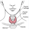Top 3 Natural Remedies For Thyroid Disorders image