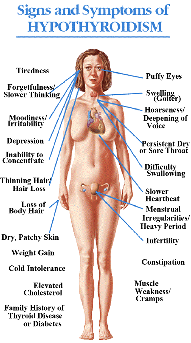 Signs and symptoms of Hypothyroidism (Underactive Thyroid)